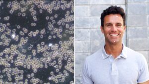 Vitalanalyse Dunkelfeldmikroskopie mit Face Reading - Joachim Bauer